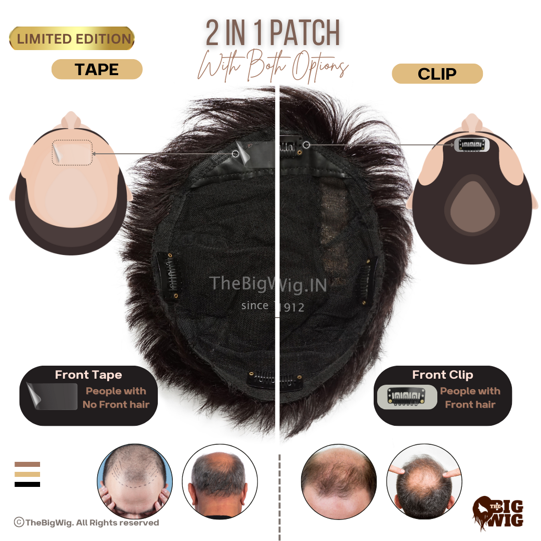 Demonstration of clipping hair patch application on a male model
