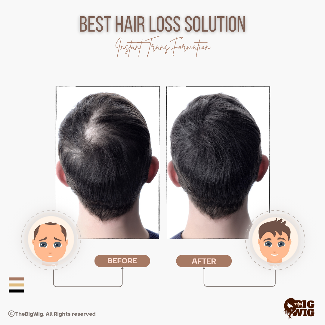 Male model wearing the clipping hair patch for a natural look