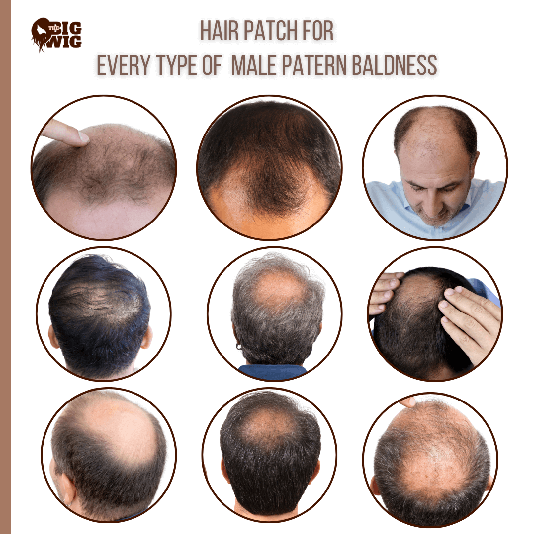 Patch wig for men with natural hair and seamless blending