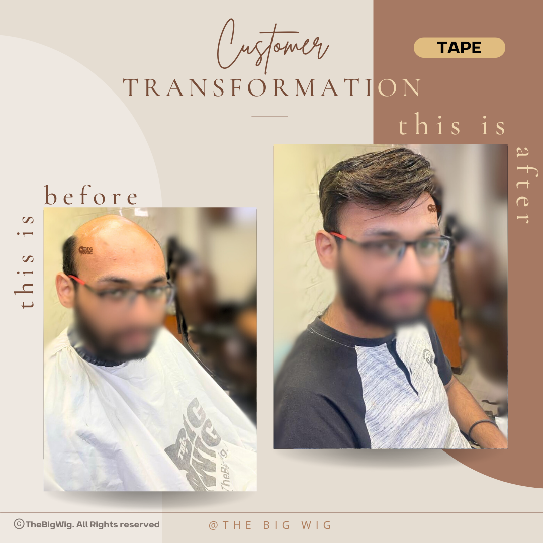 Top-quality guy hair wig offering all-day wear and comfort