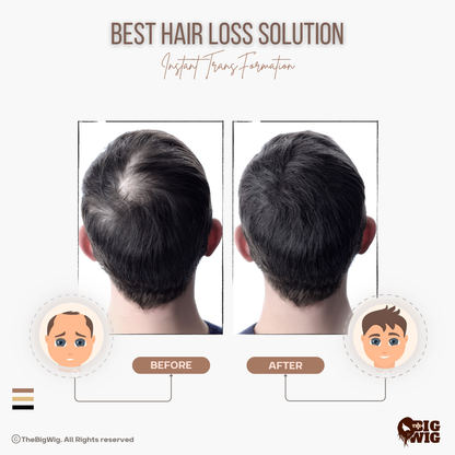Male model wearing the clipping hair patch for a natural look