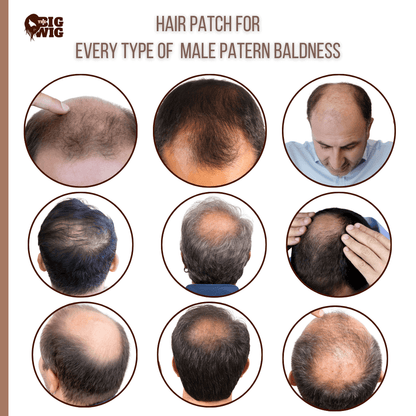 Patch wig for men with natural hair and seamless blending